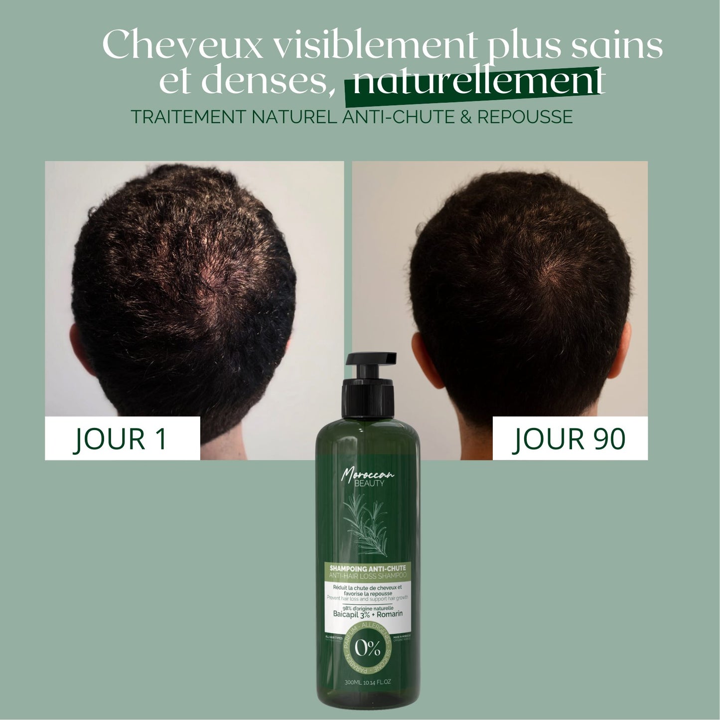 Shampoing Naturel Anti-Chute & Repousse - Baicapil 3% + Romarin | 300ml